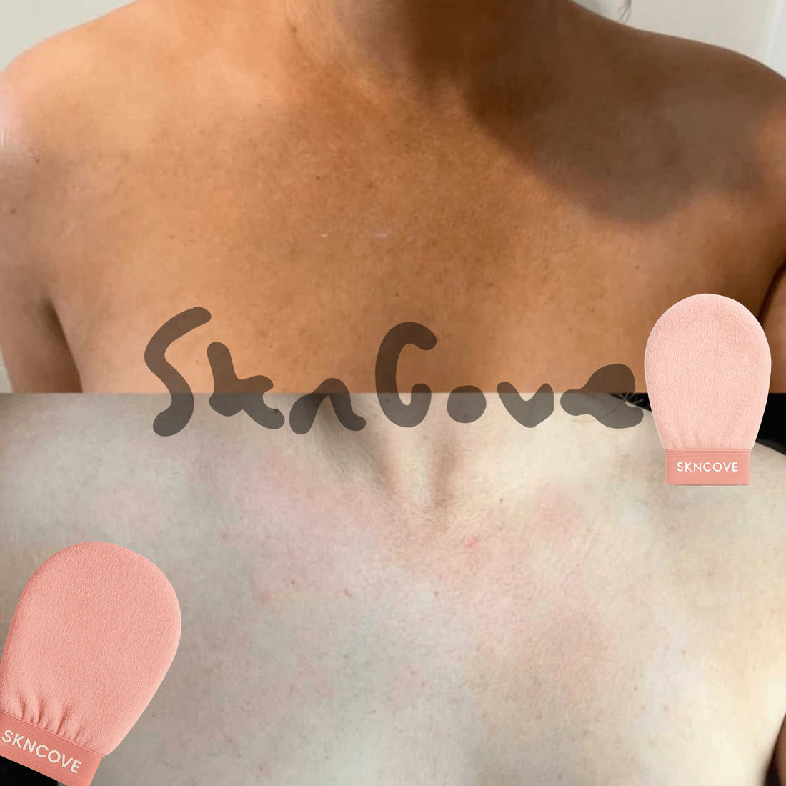 Real Results: How SknCove Transformed These Women's Skin